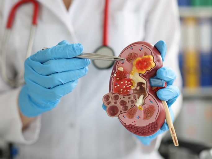 Urology Treatment