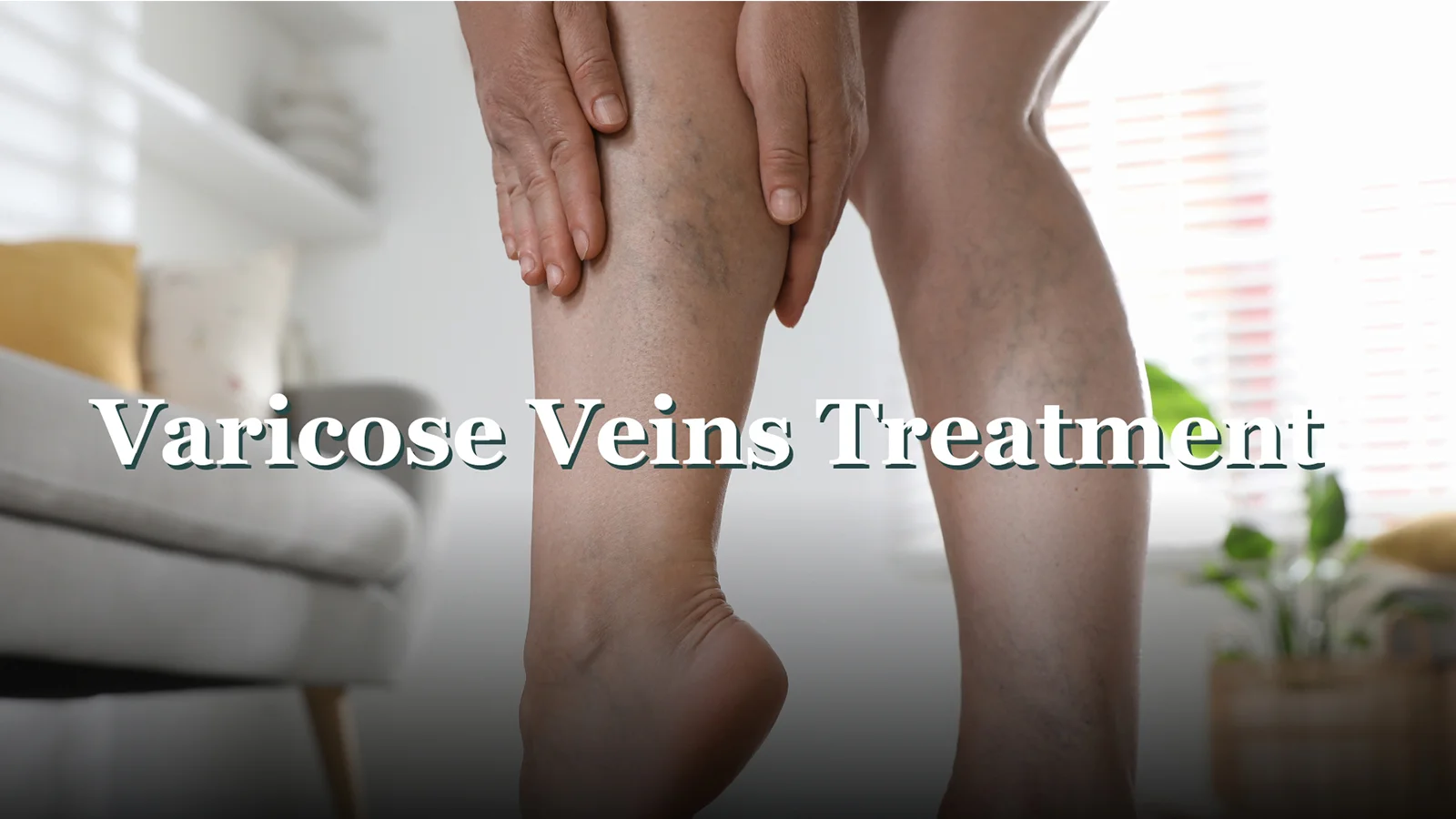 Varicose Veins Treatment: Symptoms, Causes, Diagnosis & Best Options in 2025