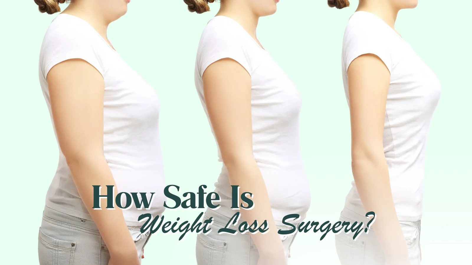 How Safe Is Weight Loss Surgery? Risks & Benefits You Should Know